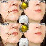 Don’t Throw Away Banana Peels! Do This Instead