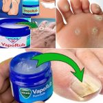 How to Make Coconut Oil at Home: A Detailed Guide