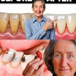 10 Surprising Benefits of Dandelion to Health