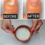 Been doing this for years! Always wake up my hubby too. Never knew the cause