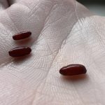 Why Do I Have Bleach Stains in My Underwear? A Complete Guide to Understanding Vaginal Discharge and Fabric Fading