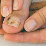 Vinegar for Fresh, Odor-Free Laundry