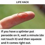 If you have these lines on your nails after 40, it is a clear sign that..