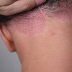 Don’t Mistake This Plant for a Mere Weed: Purslane, A Treasure Trove of Benefits!