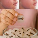 Banana peels, don’t throw them away: soak them in vinegar and you’ll see the results