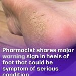 An early sign of Alzheimer’s disease can be noticed while taking a shower: what should you look out for?