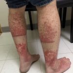 A Delicate Tool from the Good Old Days