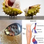 Cold or Hot? Why the Right Compress Makes All the Difference