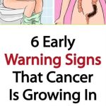 The Places You Should Never Put an Air Fryer (And Why It Matters)