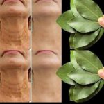 Bay Leaf: The Natural Secret to Youthful Skin!