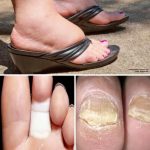 Benefits and Preparation of Natural Health Remedies: Complete Guide