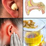 Whiten Your Teeth Naturally with Guava Leaves: Effective Homemade Recipe