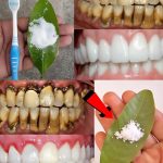 Garlic for Ear Health: Natural Relief and Protection