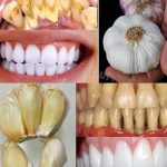 If a man doesn’t appreciate you, the most important thing to remember is that …