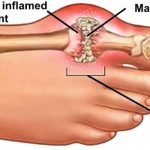 The Secret to Protecting Your Eyesight Might Already Be in Your Pantry