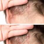 You are doing it all wrong. Here’s the right way to use ginger for nausea and colds