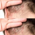 Don’t throw away rice water, keep it and do these 6 “miraculous” things, save millions every year