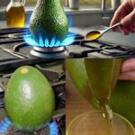 Everyone with fatty liver has this in common! A hidden sign you should know about.