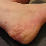 How to Check If Honey is Pure or Fake