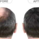 Most people are narcissists… Count the squares