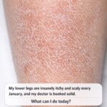 I took a spoonful of honey with lemon every morning. 5 days later, this is what happened