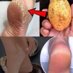 The secret of your personality can be read on your lips.