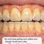 My mom drinks 10 cups of warm lemon water every day for detox. I worry it’s excessive and could lead to issues. Thoughts?