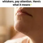 My 15 year old son been at his Nanny house for the weekend and he came back home with different sizes of bumps ..