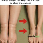 These brown spots appeared almost overnight on my chest, and I can’t see anyone until later this month. What could this be?