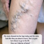 Papaya Latex Benefits: The Powerful White Sap Hidden Inside Unripe Papaya